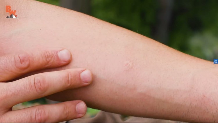At first, the sting looks small