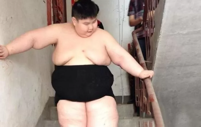 Obesity causes many challenges in Xu's daily life