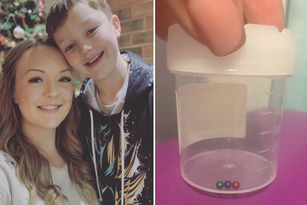 11-Year-Old Gamer Swallows Magnets Trying TikTok Trend, Ends Up in Surgery 1 Young gamer and the dangerous magnets involved