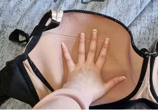 Woman Struggles with 25kg Bust and Hospital Surgery Denial 3 A one-of-a-kind bra that probably only Laura can wear