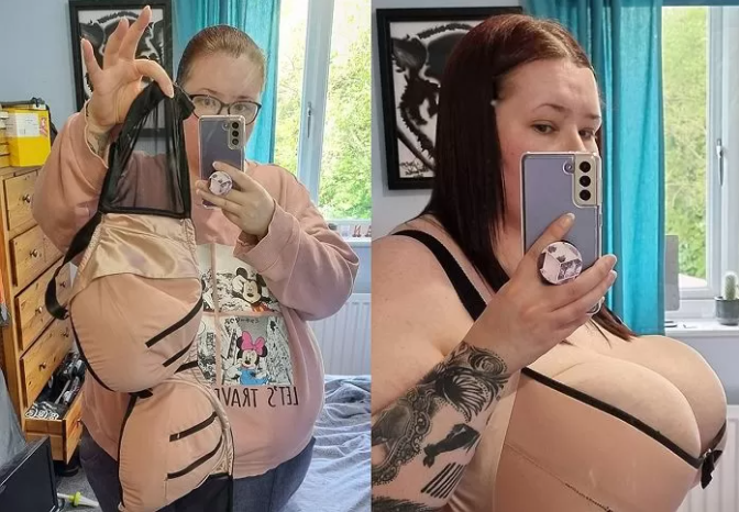 Woman Struggles with 25kg Bust and Hospital Surgery Denial 4 Laura’s oversized bust has become a major concern for her