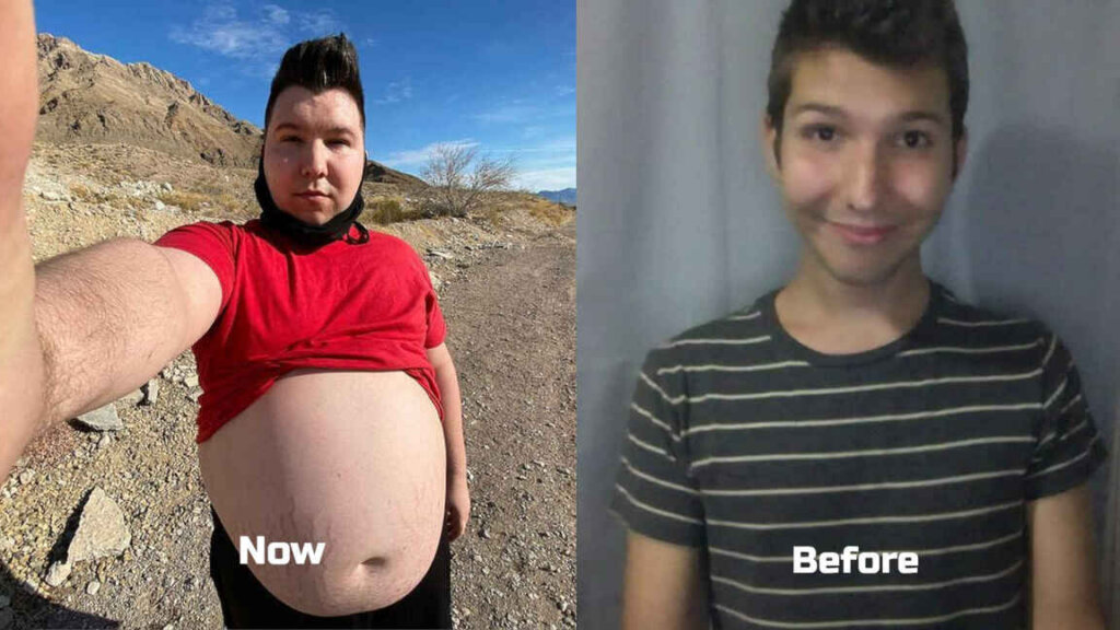 Nikocado was quite handsome before starting mukbang content