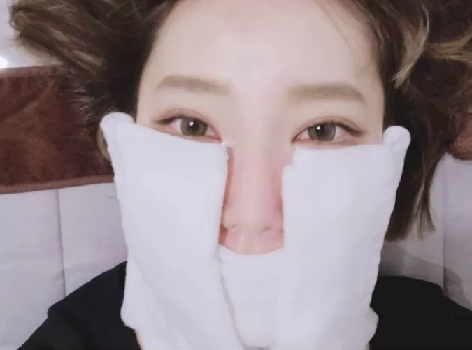 Magenta’s face during treatment