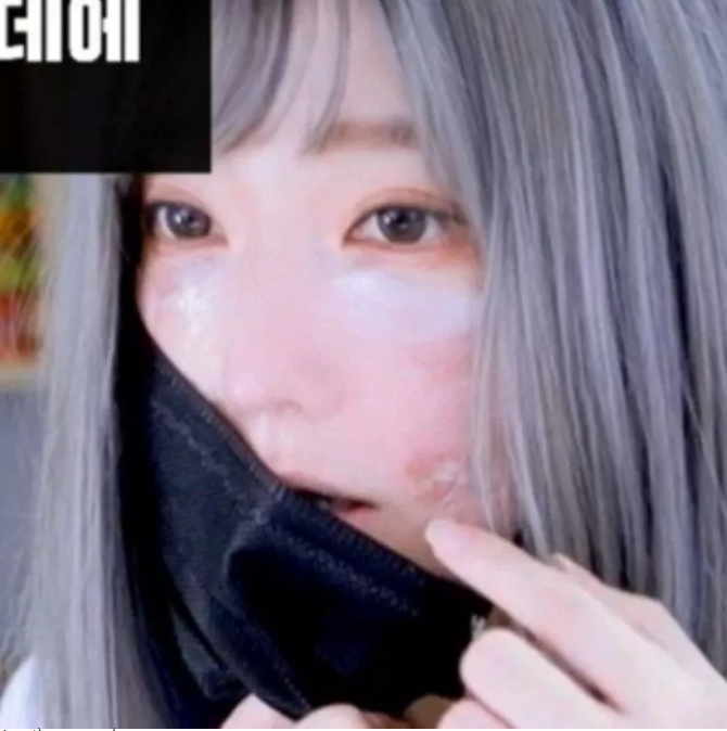 The streamer removes her mask to reveal her damaged face