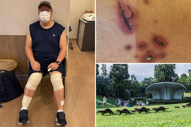 Man Attacked by 20 Otters While Jogging in Singapore Park 1 photo 1 1639477308160106235220
