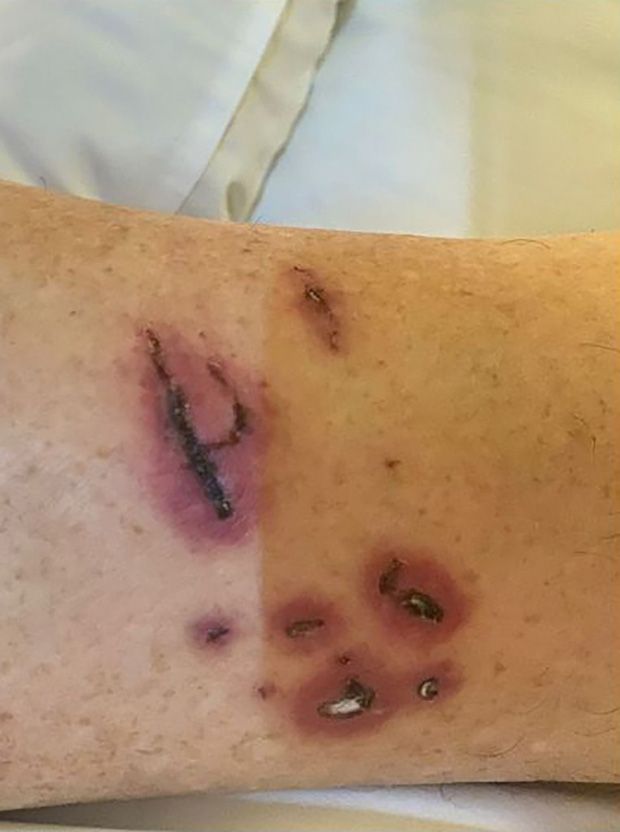 Man Attacked by 20 Otters While Jogging in Singapore Park 3 photo 2 1639477311199181154700