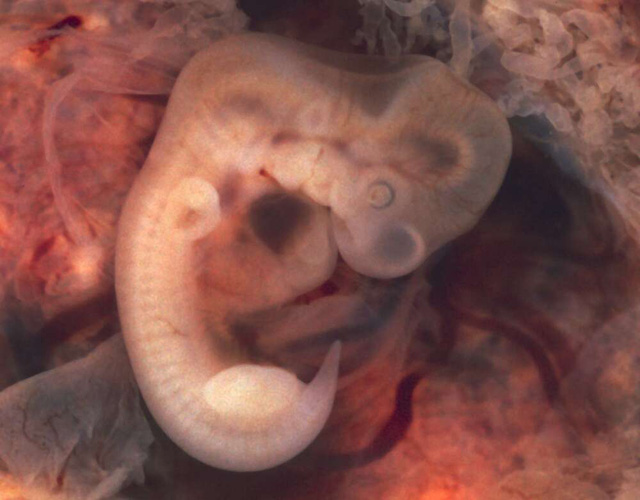 True tails are leftover embryonic tails that weren’t absorbed, like this 7-week-old embryo with a visible tail.