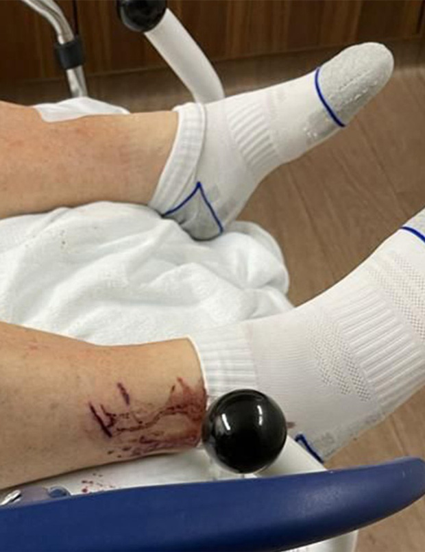 Man Attacked by 20 Otters While Jogging in Singapore Park 4 photo 3 1639477311220692271413