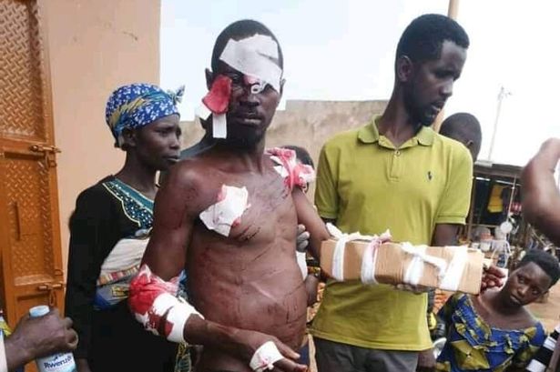 Injuries sustained by the young man in the story