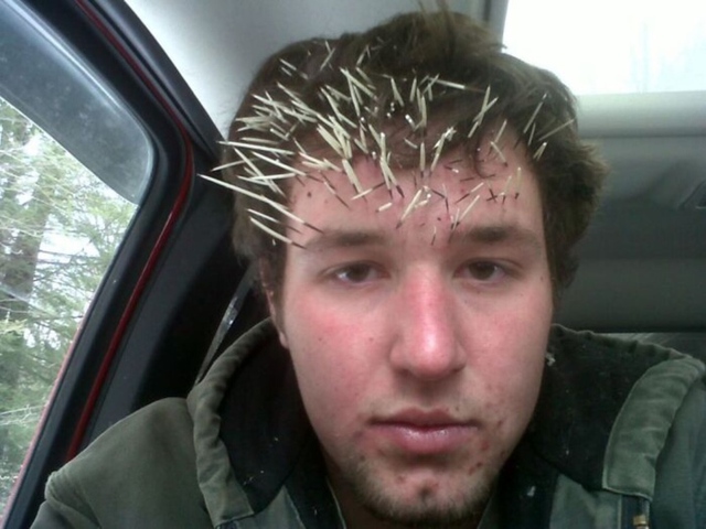 I’m in pain, I’m defeated after teasing the porcupine.