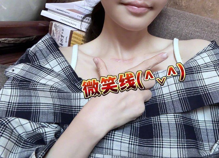Top Chinese Streamer Phung De Mac’s Life After Hiatus 7 Photo she shared showing a long scar after surgery