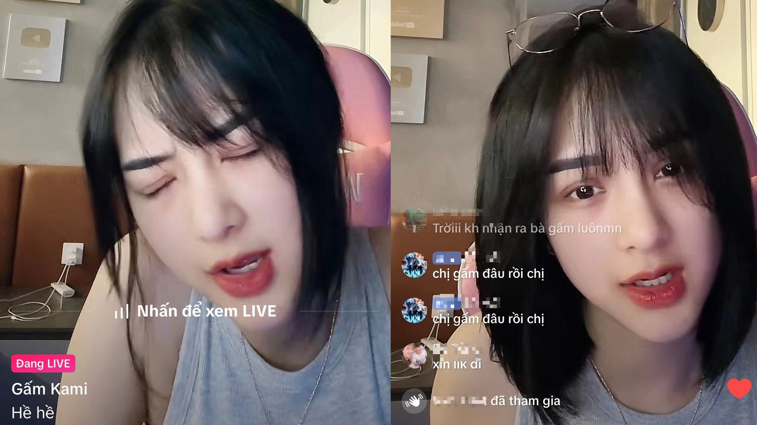 Gấm Kami Stuns Fans with Dramatic Post-Surgery Look 1 Gấm Kami during last night's live stream.
