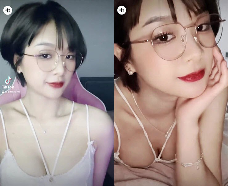 Gấm Kami Opens Up About Her Decision to Get Cosmetic Surgery 1 picture 9 1678803064 807 width740height603 1716521403074584068500