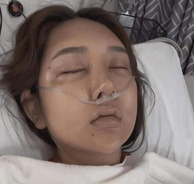 Chinese Streamer Spends $8M on Beauty Dream, Faces Tragic Fallout 1 photo 1722398181272 17223981815331869720921