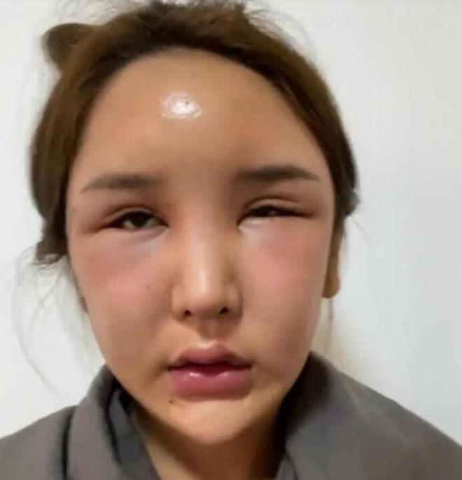 Chinese Streamer Spends $8M on Beauty Dream, Faces Tragic Fallout 2 photo 1722398189662 1722398189749761336301