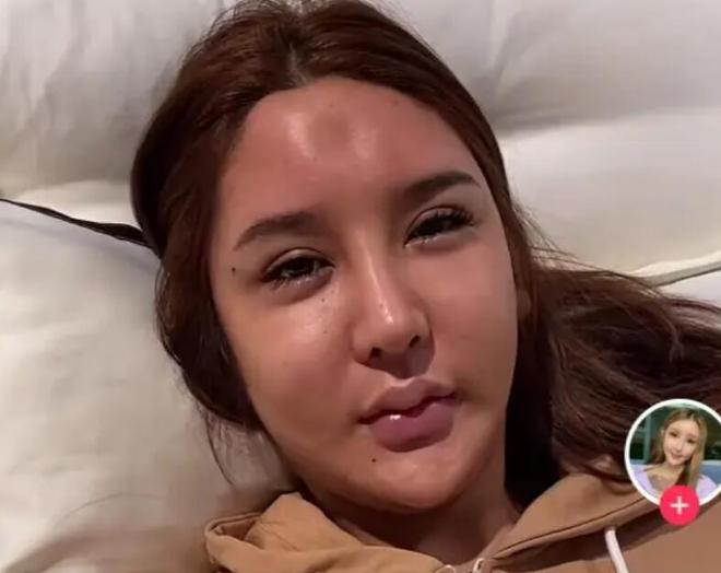 Chinese Streamer Spends $8M on Beauty Dream, Faces Tragic Fallout 3 photo 1722398214646 1722398214820554836653