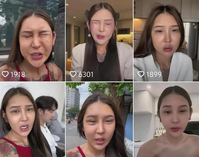 Chinese Streamer Spends $8M on Beauty Dream, Faces Tragic Fallout 5 photo 1722398226817 17223982268981061386315