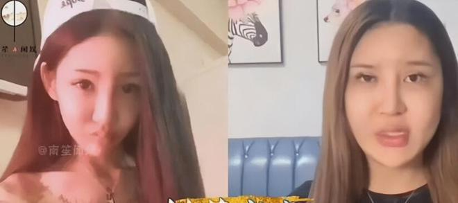 Chinese Streamer Spends $8M on Beauty Dream, Faces Tragic Fallout 6 photo 1722398237344 17223982375001897282516