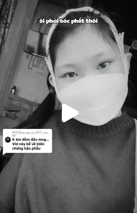 Esports MC Khánh An’s Face Surgery Sparks Mixed Reactions 1 edit screenshot 2024 08 09 161523 17231949439051460105795
