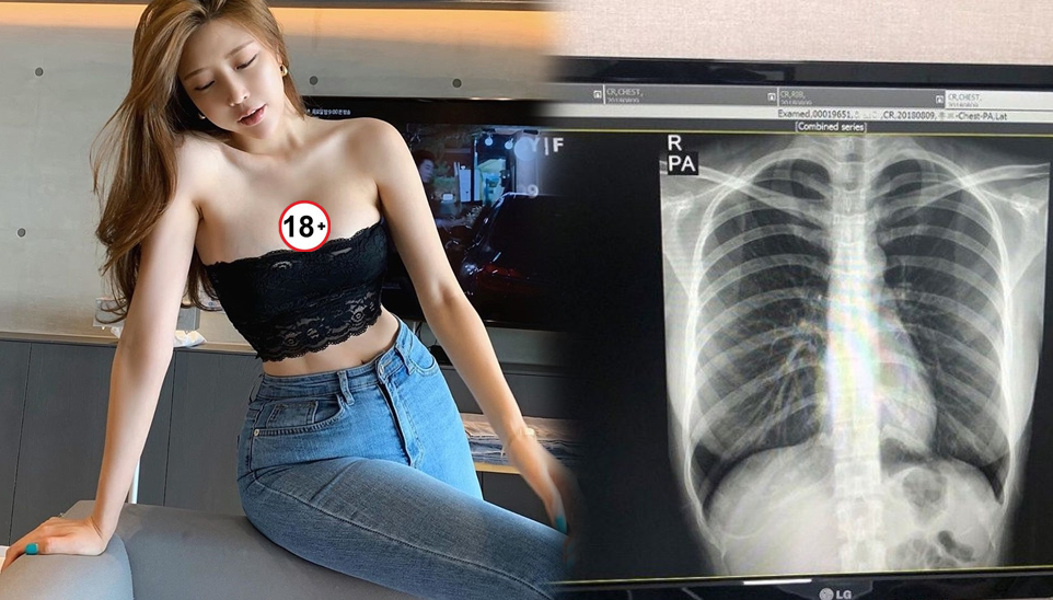 Streamer Choi Somi Rejects $30M Offer, Stuns Fans 3 Choi Somi in bikini