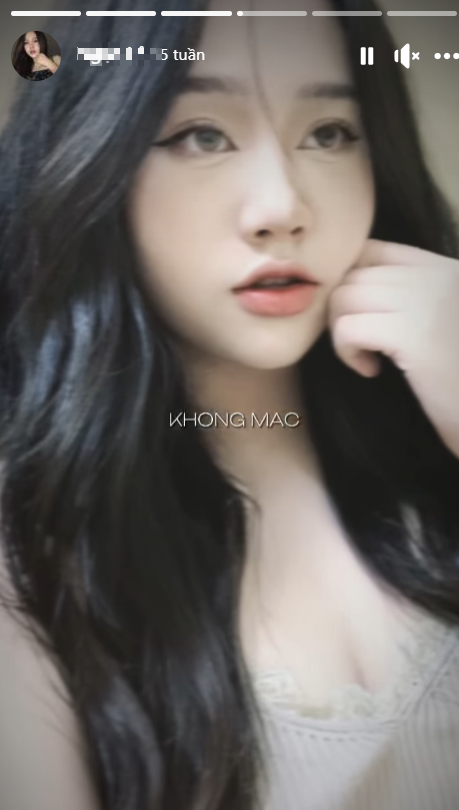 Fan Stuns Fans Posing with Refund's Nhism, Stealing the Spotlight 8 Ngoc Le casual photo 3