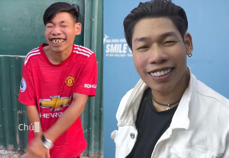 Ngân Baby’s New Look One Year After Viral Engagement 2 Thông Soái Ca’s transformation.