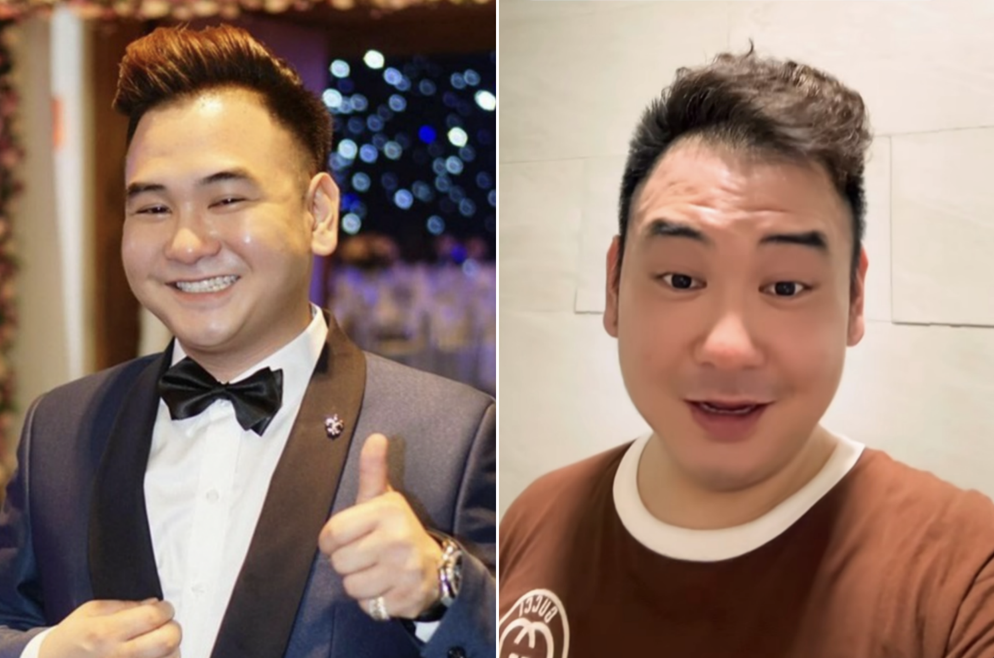 Fans worry seeing Xemesis’s current look.