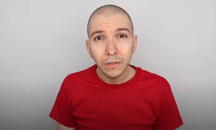 YouTuber Gains 171kg Doing Mukbang, Keeps Filming Even on a Ventilator 3 Nicholas Perry slim comeback