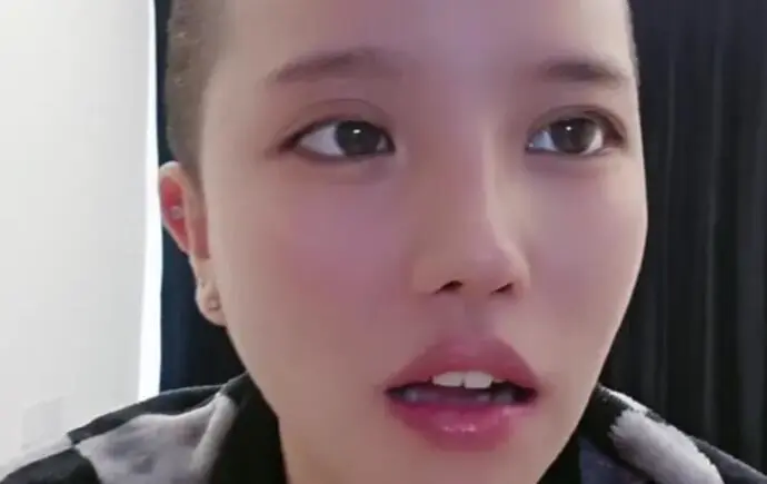 Streamer Goes Live Right After Skull Surgery 1 Streamer Duong Lieu after skull surgery