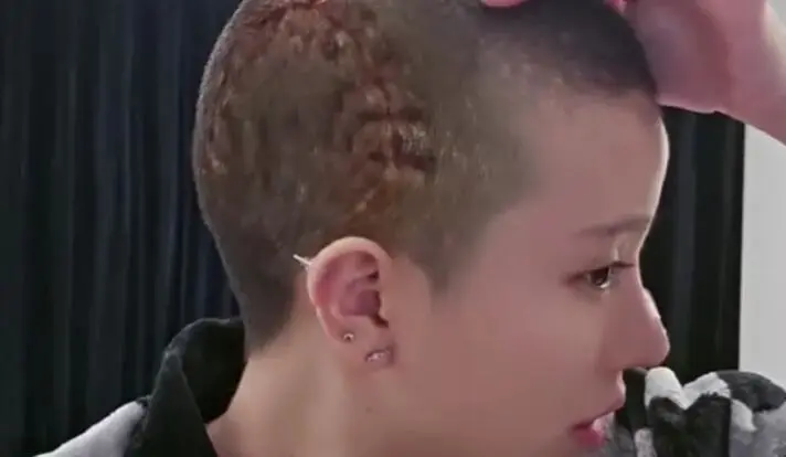 Streamer Goes Live Right After Skull Surgery 2 Duong Lieu livestreaming with visible injury