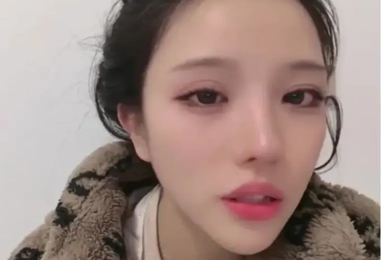 Streamer Goes Live Right After Skull Surgery 3 Duong Lieu showing her recovery progress