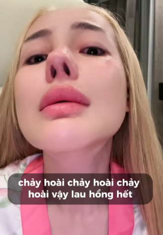 Ngân 98 shares health issues
