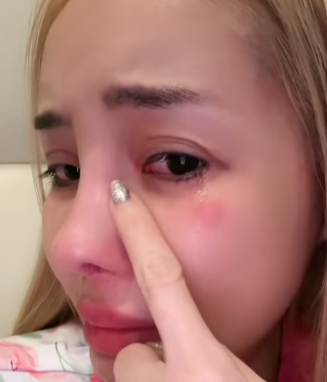 Ngân 98 cosmetic surgery update