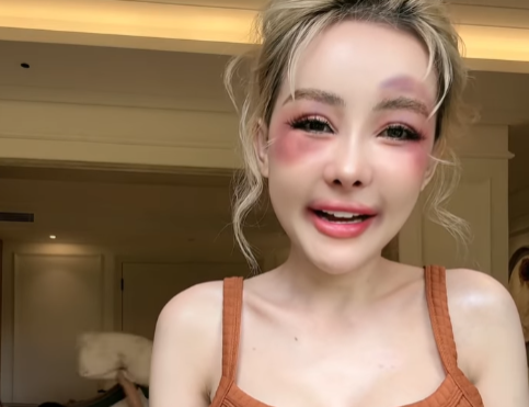 Ngân 98 openly shares her personal life on social media