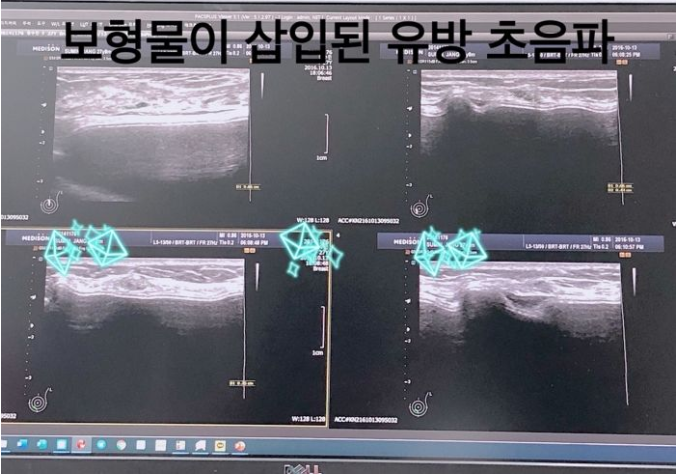 Streamer Yeoam Proves Her Natural Look with Live X-Ray 4 screenshot8 15948690946531084318599 1747710297278 17477102973771360205619 1747725683371 1747725683498851730822