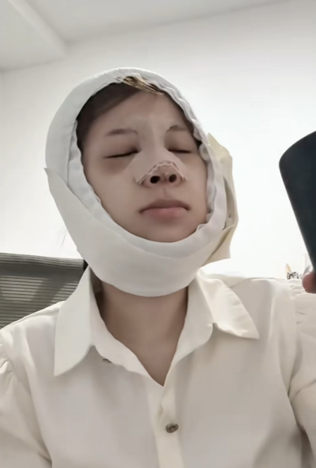 TikToker ChangMie Opens Up About Her Cosmetic Surgery Journey 5 screenshot 2025 06 06 160426 1749200677503811153012 1749201818926 17492018190401083326986
