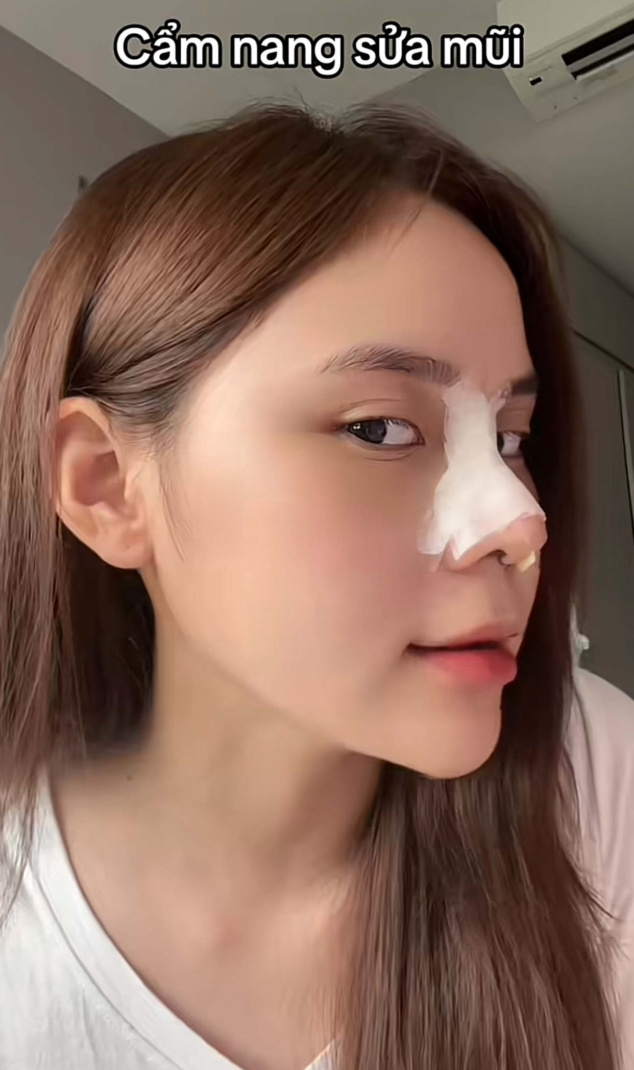 TikTok Star La Hoàng Kỳ Duyên’s Stunning New Look After Nose Surgery 4 Kỳ Duyên reveals her nose transformation process.