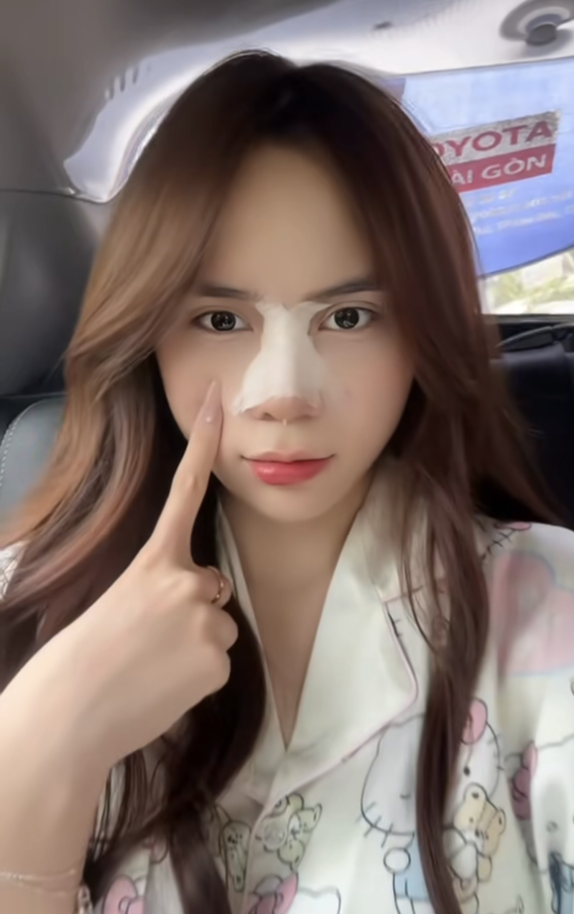 TikTok Star La Hoàng Kỳ Duyên’s Stunning New Look After Nose Surgery 7 Photos Kỳ Duyên shared after her nose surgery.