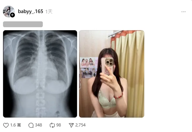 Streamer Sparks Outrage with X-Ray Photo Going Viral 2 Tutu's bold social media post
