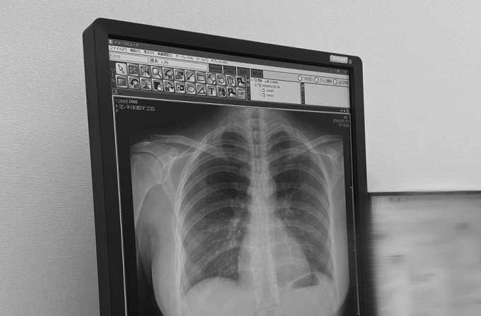 Close-up of Kokoro Toyoshima's X-ray highlighting body contours