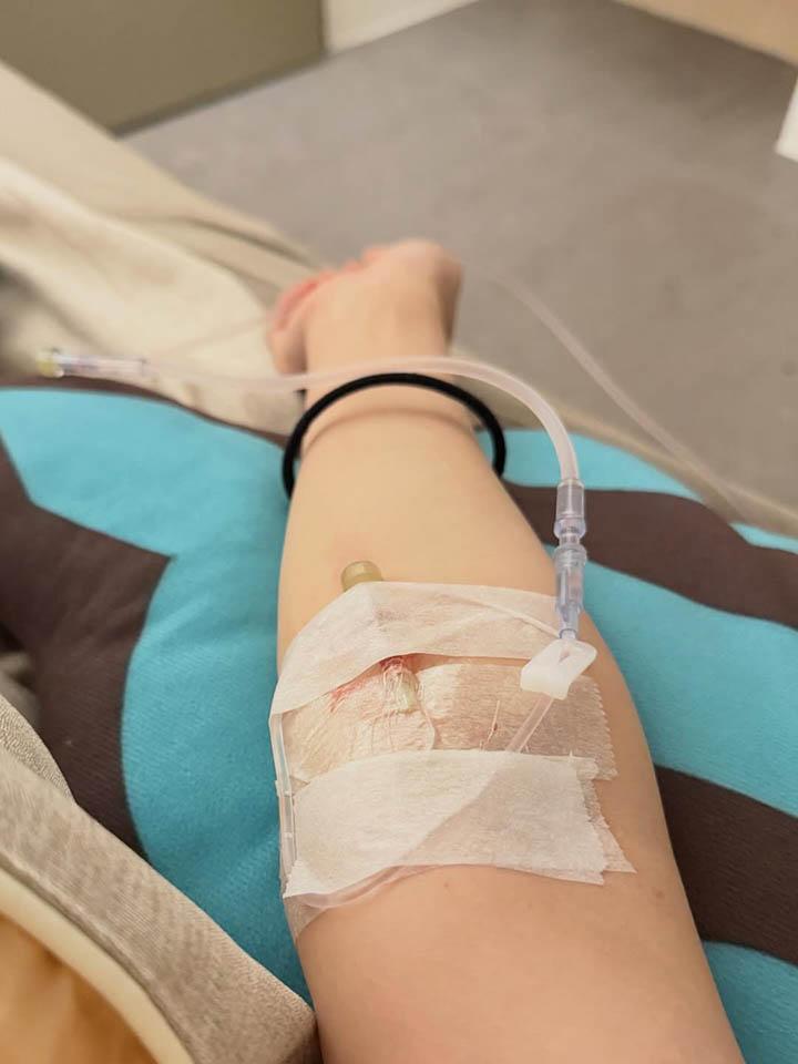 Hane Ame receiving IV drip in hospital