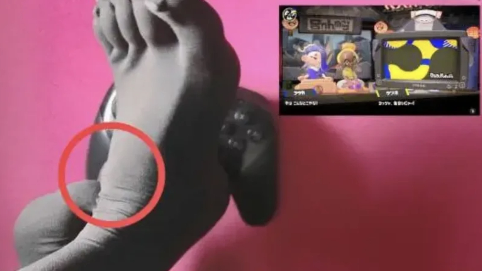 Close-up of Amakusa Miro's foot showing muscle growth