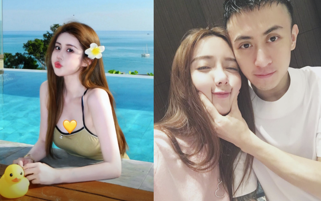 Vi Tuyết cosmetic surgery