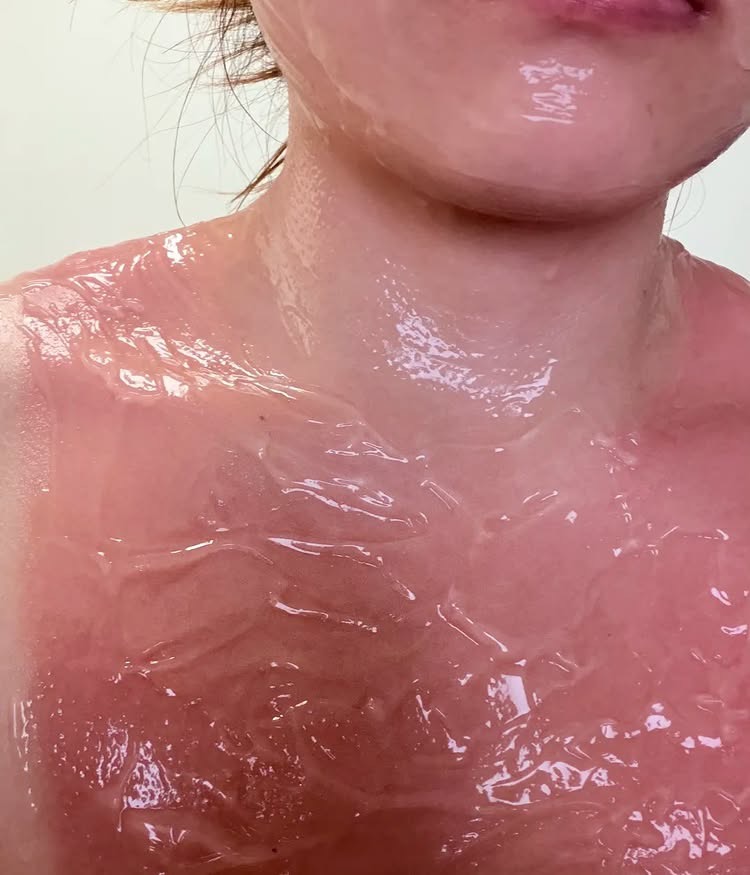 The Hidden Pain Behind Stunning Summer Beach Photos 4 Applying soothing gel on sunburned skin