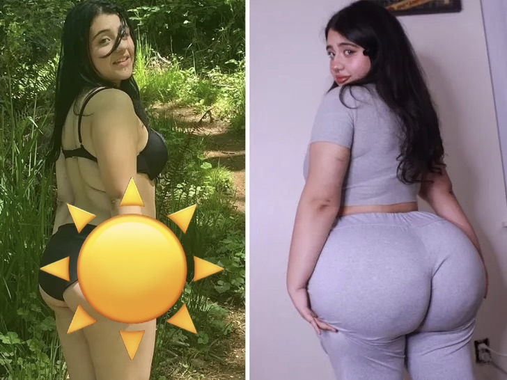 May Ling’s Billion-Dollar Quest for the Biggest Butt in the World 1 May Ling posing after Brazilian Butt Lift surgery