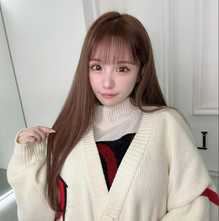 Japanese Influencer Spends $350K on Surgery, Shares Stunning Before and After 6 Hirase Airi recovery process