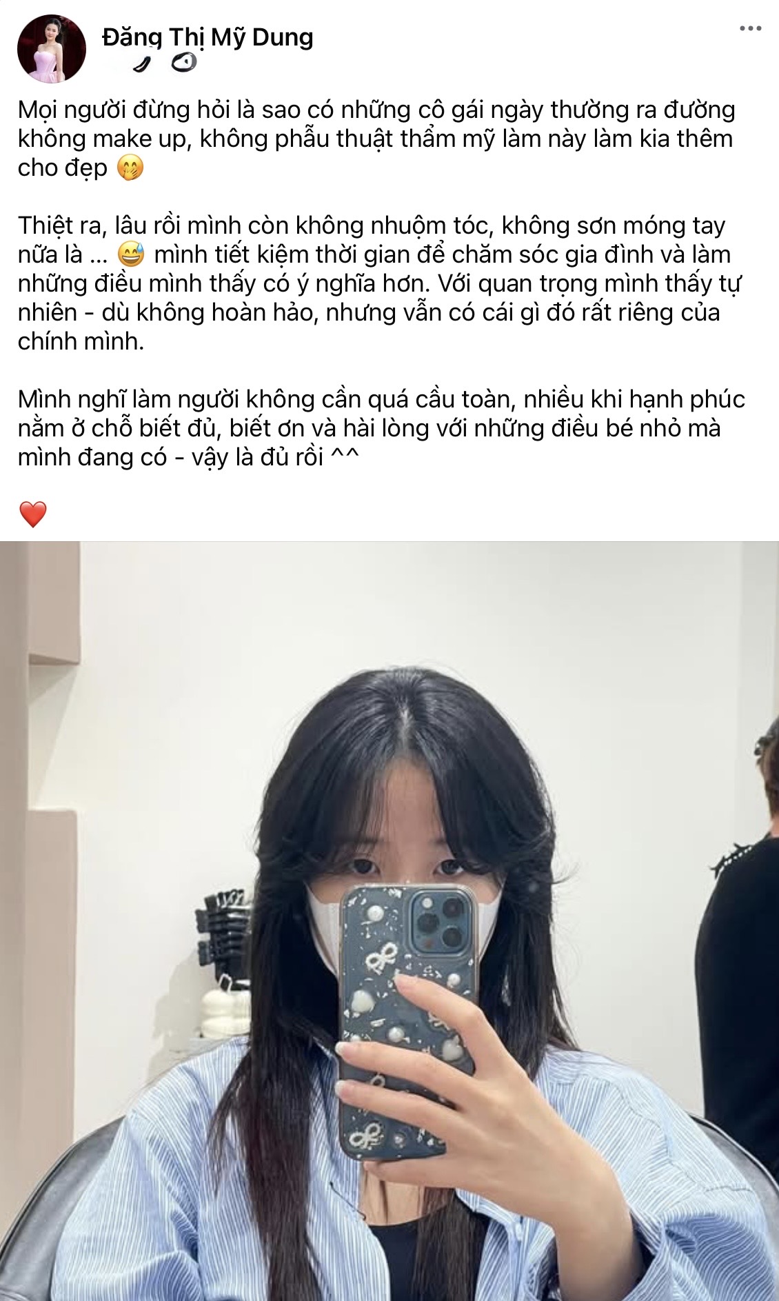 Midu Opens Up About Going Makeup-Free Amid Beauty Debates 2 Midu's natural face sparks debate